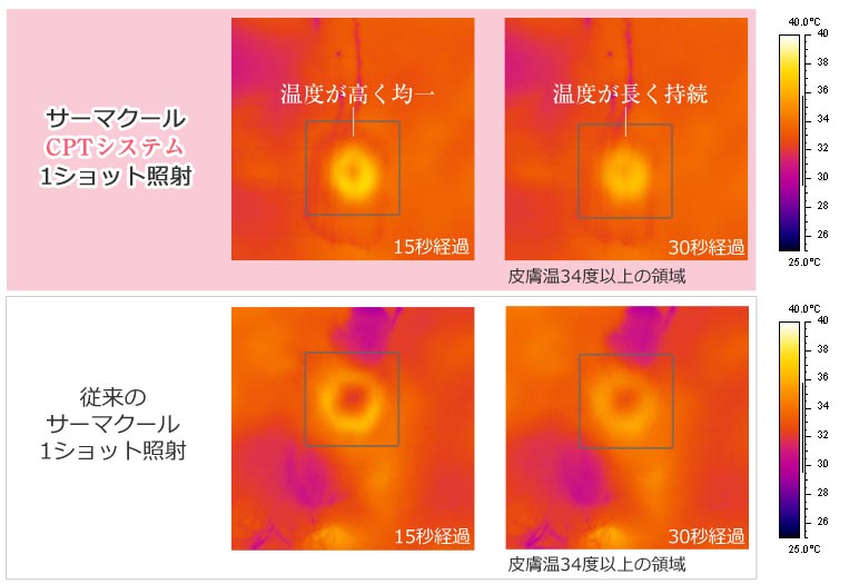 照射後の表